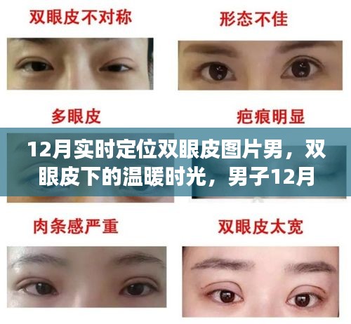 男子雙眼皮恢復(fù)之旅，冬季溫暖時(shí)光與友情的碰撞