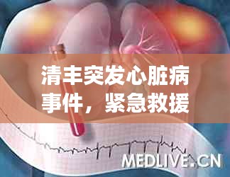 清豐突發(fā)心臟病事件，緊急救援引發(fā)公眾健康意識(shí)覺(jué)醒覺(jué)醒時(shí)刻