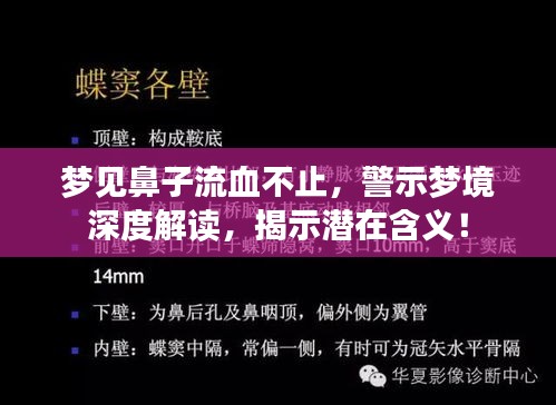 夢見鼻子流血不止，警示夢境深度解讀，揭示潛在含義！
