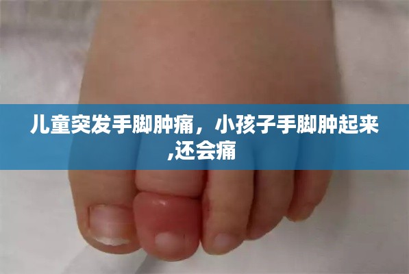 兒童突發(fā)手腳腫痛，小孩子手腳腫起來,還會痛 