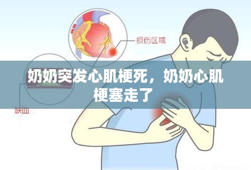 奶奶突發(fā)心肌梗死，奶奶心肌梗塞走了 