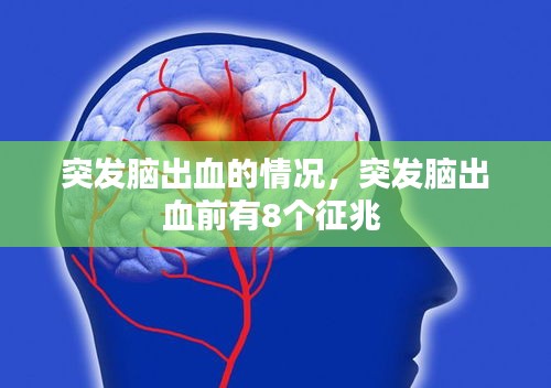 突發(fā)腦出血的情況，突發(fā)腦出血前有8個征兆 