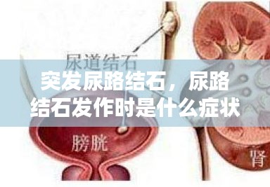 突發(fā)尿路結(jié)石，尿路結(jié)石發(fā)作時(shí)是什么癥狀? 