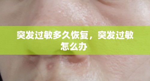 突發(fā)過敏多久恢復(fù)，突發(fā)過敏怎么辦 