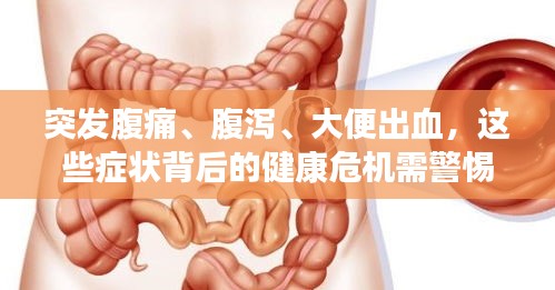 突發(fā)腹痛、腹瀉、大便出血，這些癥狀背后的健康危機需警惕！