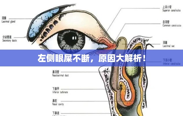 左側(cè)眼屎不斷，原因大解析！