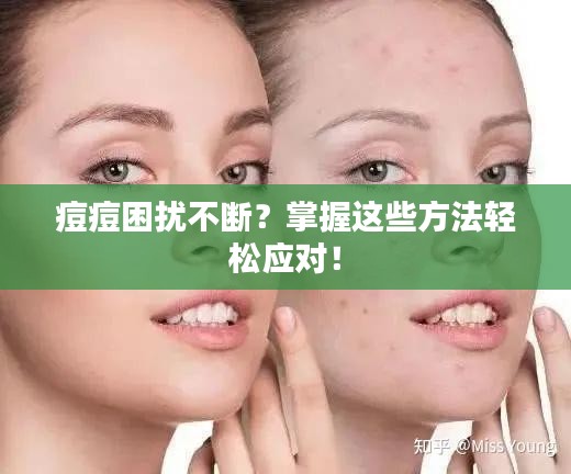 痘痘困擾不斷？掌握這些方法輕松應對！