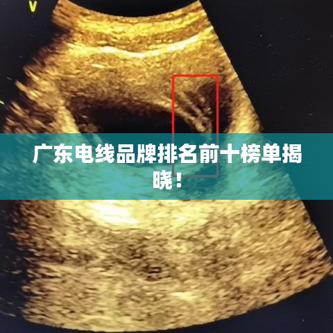 廣東電線品牌排名前十榜單揭曉！