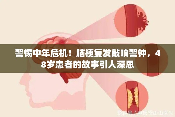 警惕中年危機(jī)！腦梗復(fù)發(fā)敲響警鐘，48歲患者的故事引人深思