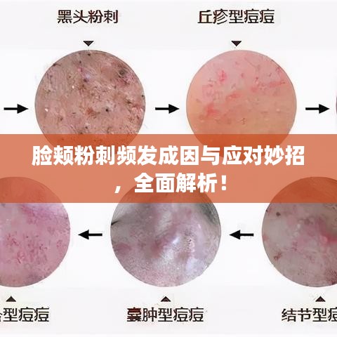 臉頰粉刺頻發(fā)成因與應(yīng)對(duì)妙招，全面解析！